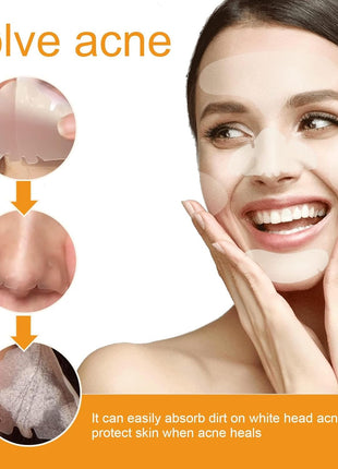 40Pcs Hydrocolloid Acne Patches Full-Face Coverage Kit for Pimples & Blemishes, Skin Care Solution for Clearing Spots