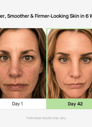 HealthyDerm 3D Stem Cell Matrixyl 3000 Peptides Complex Serum for Face