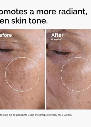 The Ordinary Glycolic Acid 7% Exfoliating Toner, Brightening and Smoothing Daily Toner for More Even-Looking Skin Tone, 8.1 Fl Oz