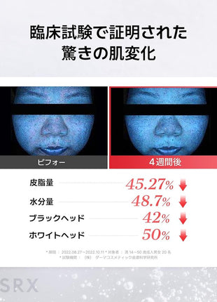 COSRX Niacinamide Beauty Serum Niacinamide 15 Serum 20ml Niacinamide 15% Lotion Highest Content in Its Class Zinc PCA Problem Care Trouble Care Blackheads Whiteheads Sensitive Skin Skincare Basic