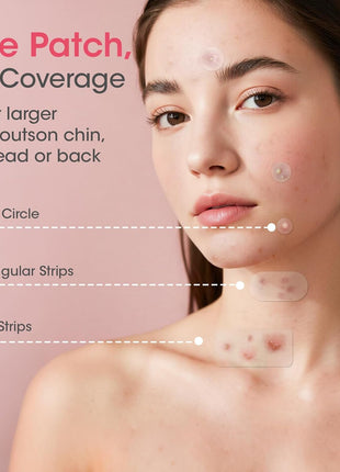 Pimple Patches for Face, 320 Counts 5 Sizes Large Patches, Hydrocolloid Blemishes Patch, Spot Dots Cover for Body, Chin, Cheek Zits & Blemish & Breakouts