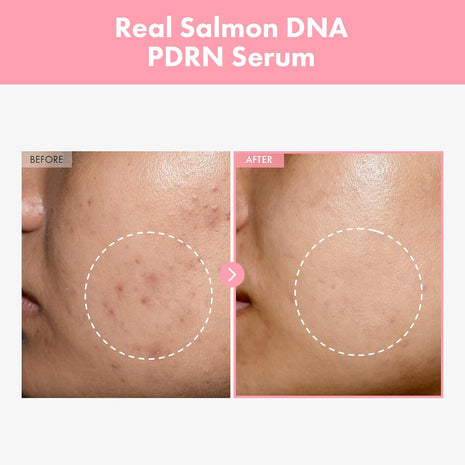 TOSOWOONG Pink Peptide 12 PDRN Serum for Firming & Glass Skin, Skin Glow