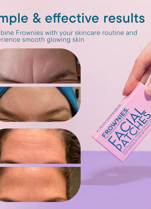 Frownies Forehead & Between the Eyes Wrinkle Patches, 144 Count | Overnight Patches for Forehead & 11 Lines