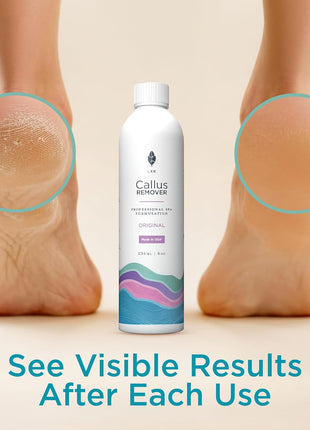 Lee Beauty Professional Callus Remover for Feet - Original, Powerful Formulation - Extra Strength Gel, Home Pedicure Foot Spa Results - Cracked & Dead Dry Skin Supplies - 8 Oz