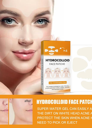 40Pcs Hydrocolloid Acne Patches Full-Face Coverage Kit for Pimples & Blemishes, Skin Care Solution for Clearing Spots