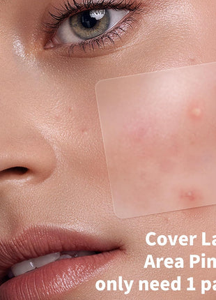 Daolyo Large Pimple Patches for Face, 8 Sizes 400 Counts XL Acne Patches, Big Hydrocolloid Bandages for Body, Chin, Forehead, Chest, Back Zit Breakouts (Strip, Square, Round, Moon)