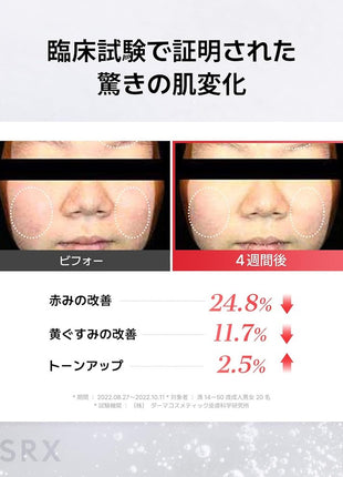 COSRX Niacinamide Beauty Serum Niacinamide 15 Serum 20ml Niacinamide 15% Lotion Highest Content in Its Class Zinc PCA Problem Care Trouble Care Blackheads Whiteheads Sensitive Skin Skincare Basic