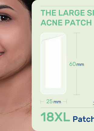 POINTMASS Large Pimple Patches for Face and Body, Hydrocolloid Acne Patches for Big Zit Breakouts and Blemish, Acne Spot Treatment w/Tea Tree Oil for Chin, Nose, Forehead, Body, Back, Neck & Chest