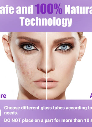 High Frequency Facial Wand-UUPAS Portable Handheld High Frequency Facial Machine Skin Facial Wand with 4 Violet Tubes