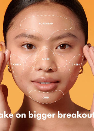 Mighty Patch Hero Cosmetics Face XL Hydrocolloid Face Mask for Acne, 5 Ct | 1 Complete Set for Nose, Chin, Forehead & Cheeks; Large Pimple Patches for Zit Breakouts; For Oily and Combination Skin