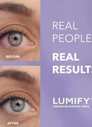 LUMIFY Eye Drops for Red Eyes, Redness Reliever for Brighter Looking Eyes, Works in 1 Minute & Lasts Up to 8 Hours, Eye Drops, 0.25 Fl Oz (7.5mL)