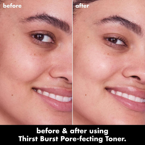 e.l.f. SKIN Thirst Burst Pore-fecting Toner Mini, Hydrating for Face, Smooths, Plumps, Pore-Minimizing, Infused with Salicylic Acid, Vegan & Cruelty-Free