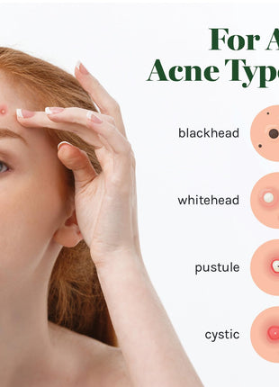 AOA Studio Absorbing Cover Healing Invisible Acne Patch Blemish Spot, Treatment, Facial Acne Patch Vegan, Cruelty Free, Hydrocolloid, Two Sizes 10mm 12mm (Total 84 Counts)