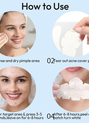 Full Face Pimple Patches (5 Pack, 25 Patches),XL Hydrocolloid Acne Patches for Whole Face,Nose,Chin,Forehead,Cheeks w/Tea Tree Oil&Salicylic Acid,Large Invisible Zit Patches for Overnight Blemish Care
