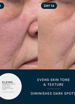 ELEMIS Anti-Aging Travel Kit Healthy Skin Trio, 3 Piece Set ($100 Value)