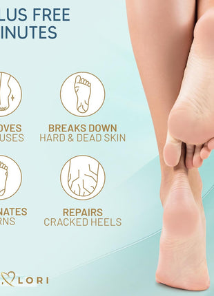 Love Lori Foot Callus Remover Gel Extra Strength Pedicure Tool for Feet 6oz | Quickly, easily, softens and removes dead, hard skin on heels & feet; salon-quality pedicure results at home