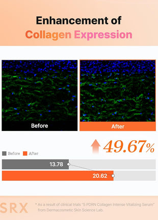 COSRX 5 PDRN Collagen Serum, Anti-aging, Glass Skin & Plumping, 3.38 fl oz