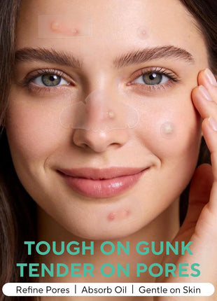 QUSTERE 580 Count Pimple Patches for Face, Large Hydrocolloid Acne Patches Stickers Bandages, Blemishes Zit Breakouts for Cheeks, Forehead, Chin, Nose for Full Face & Body | 7 Sizes | 4 Shapes