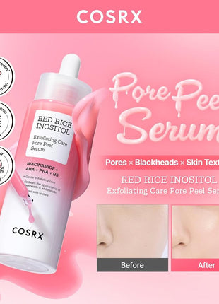 COSRX レッドライス つるすべピーリングセラム(ウォッシュオフ) 80ml 洗い流す美容液 ゴマージュ 毛穴の黒ずみ 古い角質オフ 皮脂・角質ケア 化粧ノリUP ナイアシンアミド セラミド パンテノール ビタミンB12 コスアールエックス 基礎化粧品 韓国コスメ 韓国スキンケア