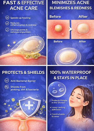 KAII Pimple Patches for Face 72 Hydrocolloid Acne Patches - Zit Patches for Facial Treatments & Masks Effective Hydrocolloid Patch Pimple Patch Roll for Blemish Care, parches para