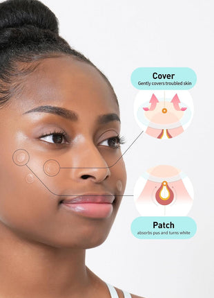 OLIVE YOUNG Care Plus Spot Patch | Hydrocolloid Acne Korean Spot Patch to Cover Zits, Pimples and Blemishes, for Troubled Skin and Face (Hydrocolloid, 102 Count (Pack of 1))