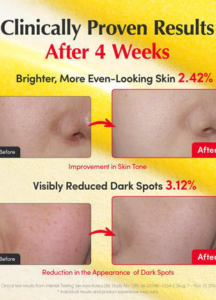 EQQUALBERRY Vitamin Illuminating Serum | Niacinamide 4% & TXA | Brightening Vitamin C Serum for Face Glow with Hyaluronic Acid | Dark Spot & Uneven Tone Care | Korean Skincare, 1.01 fl oz