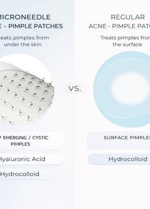 Microdart Pimple Patches- Cystic Acne Patch – Microneedle Pimple Patch for Face, Dark Spots & Blind Pimples- 18ct