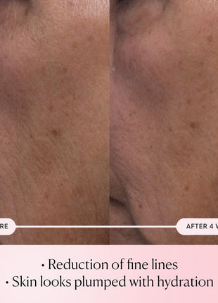 ELEMIS Pro-Collagen Rose Micro Serum, Hydration serum to plump skin, 30ml