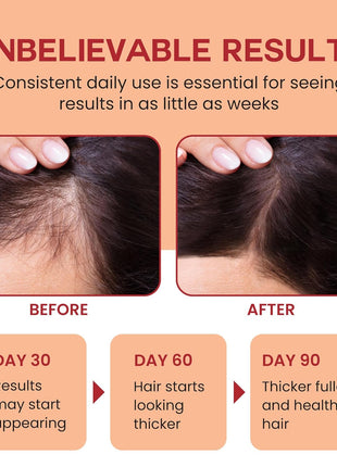 Lebanta Raw Batana Oil for Hair Growth - 100% Pure, Organic 4oz Batana from Honduras for Thick and Strong Natural Hair - Dr. Sebi Unrefined Cold Pressed Cosmetic Scalp Mask for Men & Women (1 Pack)