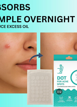 BAKE Salicylic Acid Pimple Patches, 72 Dots, Hydrocolloid Waterproof Acne Treatment, All Skin Types
