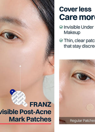 FRANZ Invisible Post-Acne Mark Patches, Tone-Care Dots (12 Count Trial) | 0.013mm matte film with niacinamide, tranexamic acid, glutathione & bakuchiol. UPF 50+ trial size, makeup-friendly