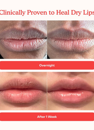 Tower 28 LipSoftie Tinted Lip Balm Treatment - Hydrating Glossy Balm + Overnight Lip Mask with Jojoba Oil + Shea Butter - Sweet, Cushiony Formula for Smooth, Soft Lips - Watermelon Kiwi (0.38 oz)